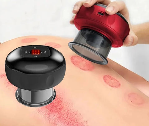 Electric Professional Grade Chinese Vacuum Therapy Cupping Suction Cups